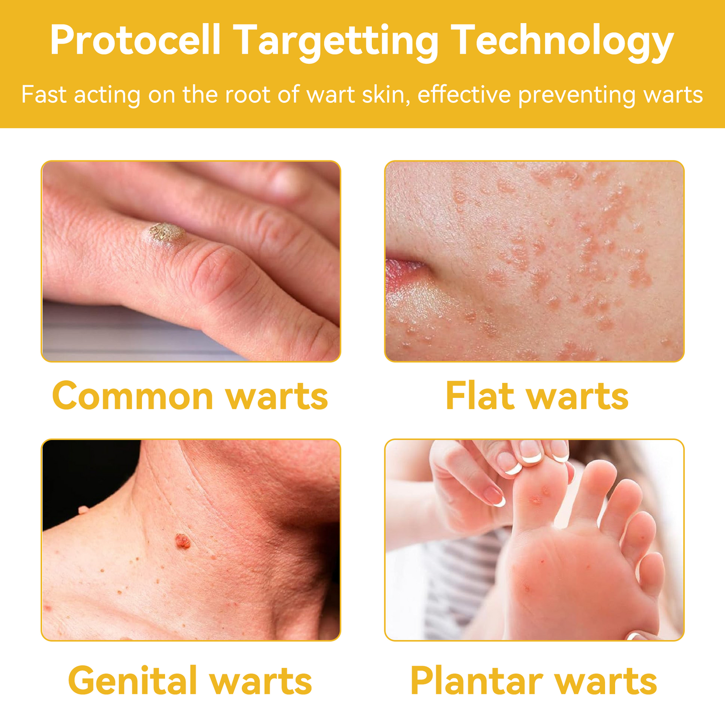 𝗧𝗟𝗢𝗣𝗔® Bee Venom Skin Treatment Cream (FDA Approved👨⚕️)💖