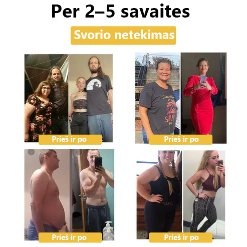 CZTICLE™ limfinės magnetinės terapijos katės akių žiedas💖Riboto laiko pasiūlymas👑👑