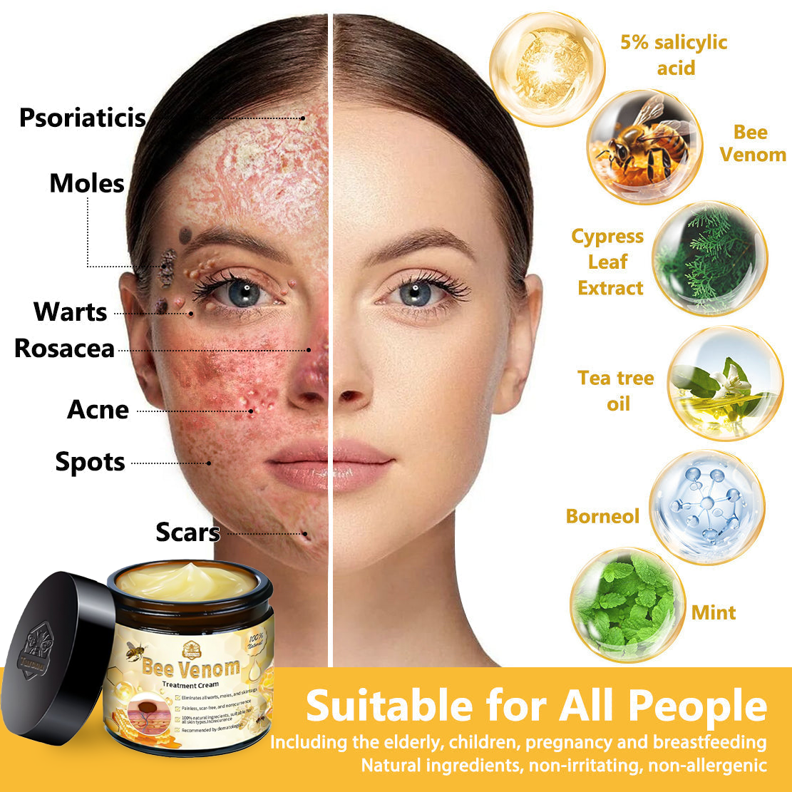𝗧𝗟𝗢𝗣𝗔® Bee Venom Skin Treatment Cream (FDA Approved👨⚕️)💖