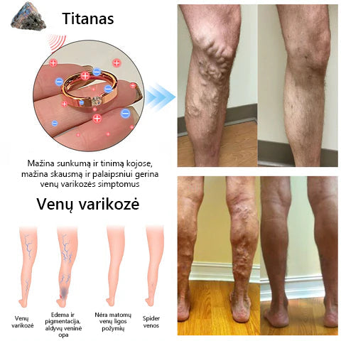 CZTICLE titano plieno magnetinis terapinis žiedas su natūraliu deimantu 🔥 Pirkite daugiau, sutaupykite daugiau 🔥🔥