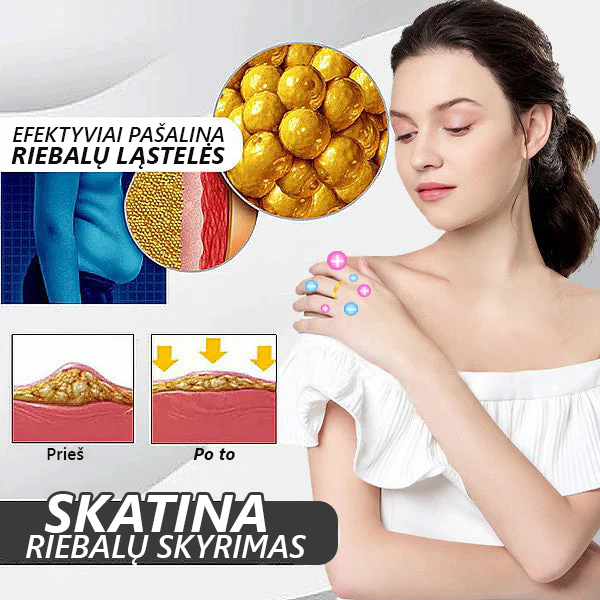 CZTICLE™ limfinės magnetinės terapijos katės akių žiedas💖Riboto laiko pasiūlymas👑👑