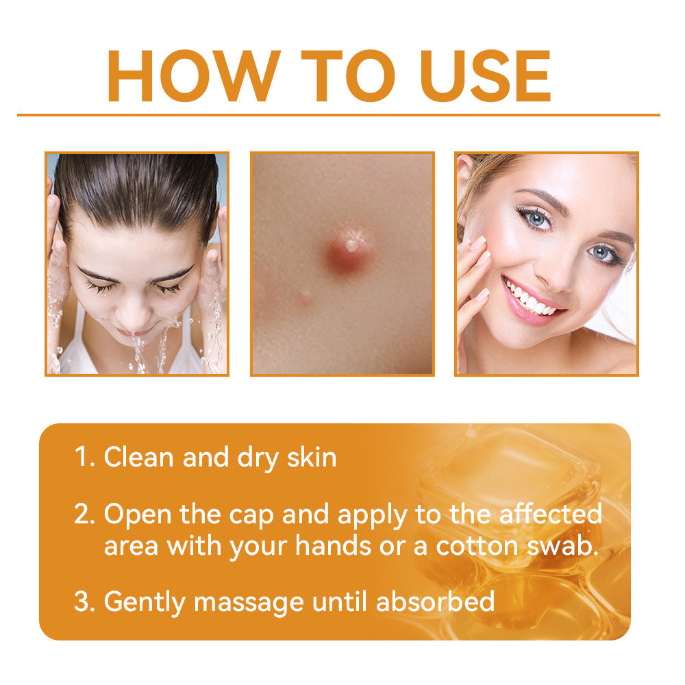 𝗧𝗟𝗢𝗣𝗔® Bee Venom Skin Treatment Cream (FDA Approved👨⚕️)💖
