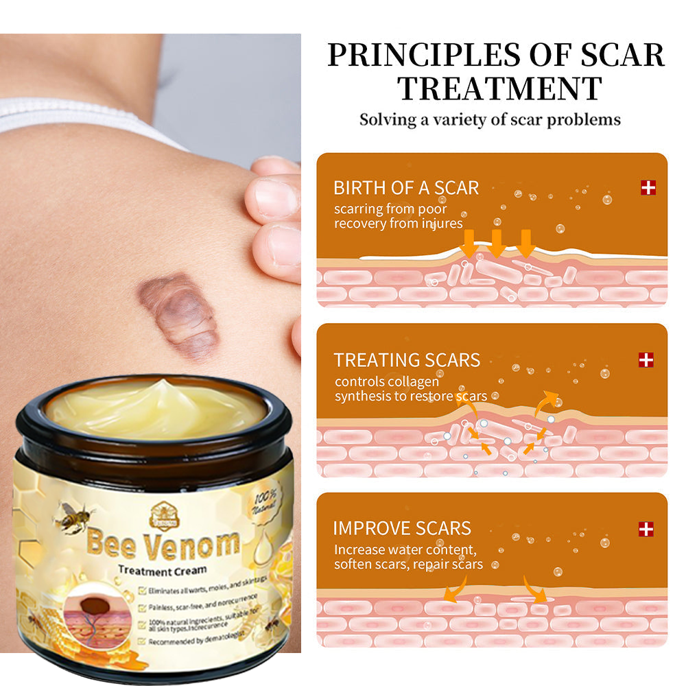 𝗧𝗟𝗢𝗣𝗔® Bee Venom Skin Treatment Cream (FDA Approved👨⚕️)💖
