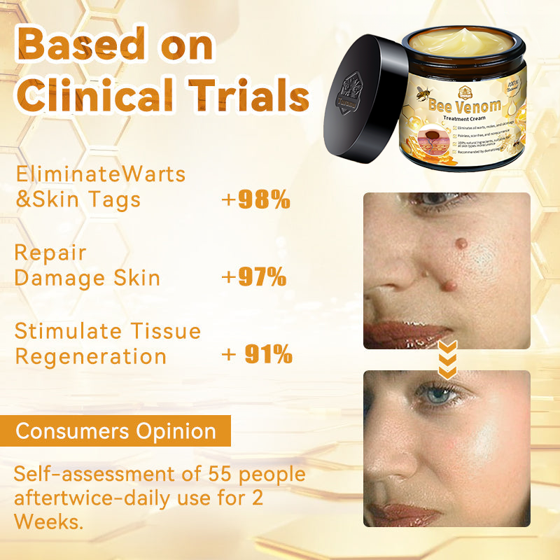 𝗧𝗟𝗢𝗣𝗔® Bee Venom Skin Treatment Cream (FDA Approved👨⚕️)💖