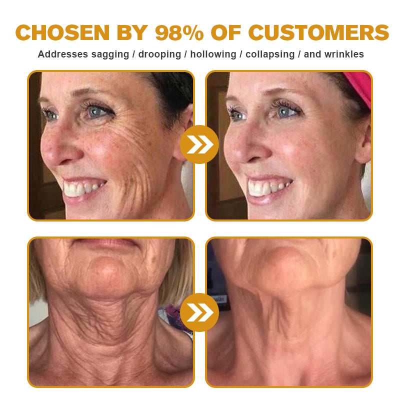 👨⚕️ Made and Shipped from USA✅ TLOPA® Botox Bee Venom Wrinkle Removal Cream- LAST DAY 80% OFF