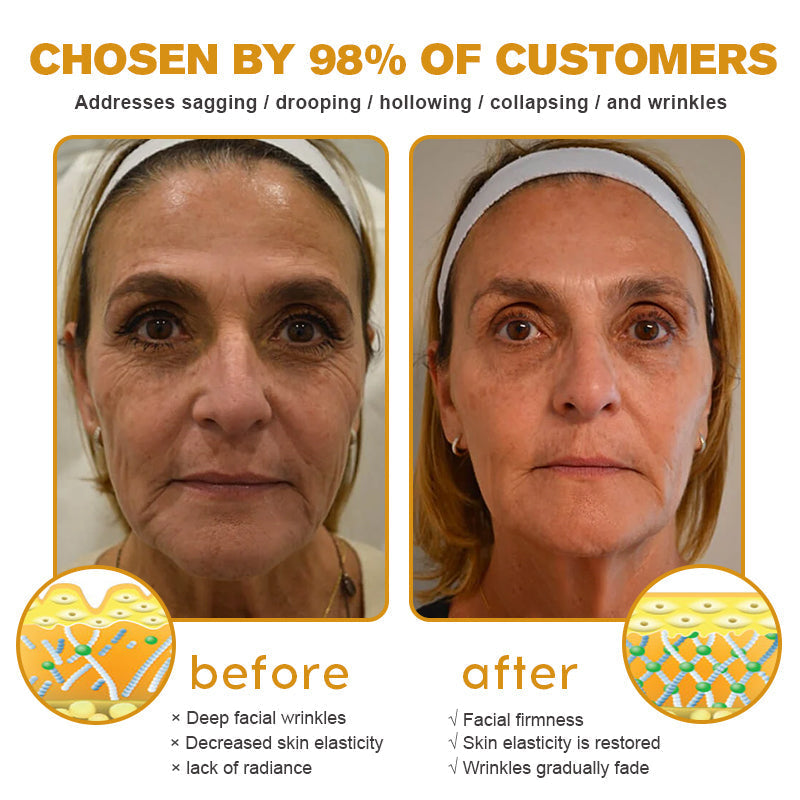 👨⚕️ Made and Shipped from USA✅ TLOPA® Botox Bee Venom Wrinkle Removal Cream- LAST DAY 80% OFF
