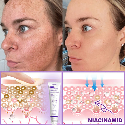 Offizieller Store✅: Vitalisys® PDRN Körpercreme mit Roller ✨ – Anti-Aging, Feuchtigkeitspflege, Hautstraffung, Lifting & Regeneration. Für ebenmäßigen Teint, Behandlung von Akne & Pigmentflecken, Warzen 🥇