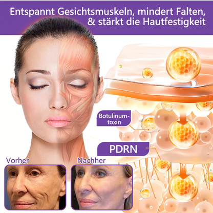 Offizieller Store✅: Vitalisys® PDRN Körpercreme mit Roller ✨ – Anti-Aging, Feuchtigkeitspflege, Hautstraffung, Lifting & Regeneration. Für ebenmäßigen Teint, Behandlung von Akne & Pigmentflecken, Warzen 🥇