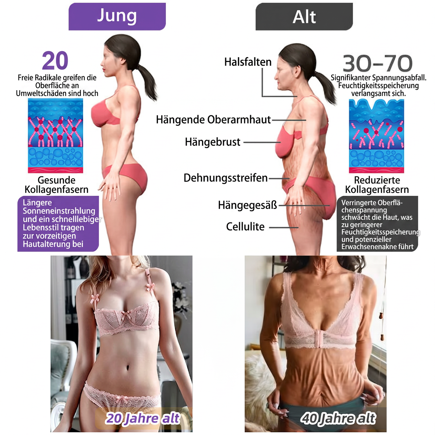 Offizieller Store✅: Vitalisys® PDRN Körpercreme mit Roller ✨ – Anti-Aging, Feuchtigkeitspflege, Hautstraffung, Lifting & Regeneration. Für ebenmäßigen Teint, Behandlung von Akne & Pigmentflecken, Warzen 🥇