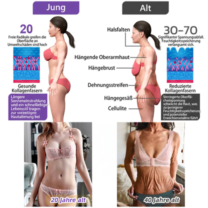 Offizieller Store✅: Vitalisys® PDRN Körpercreme mit Roller ✨ – Anti-Aging, Feuchtigkeitspflege, Hautstraffung, Lifting & Regeneration. Für ebenmäßigen Teint, Behandlung von Akne & Pigmentflecken, Warzen 🥇
