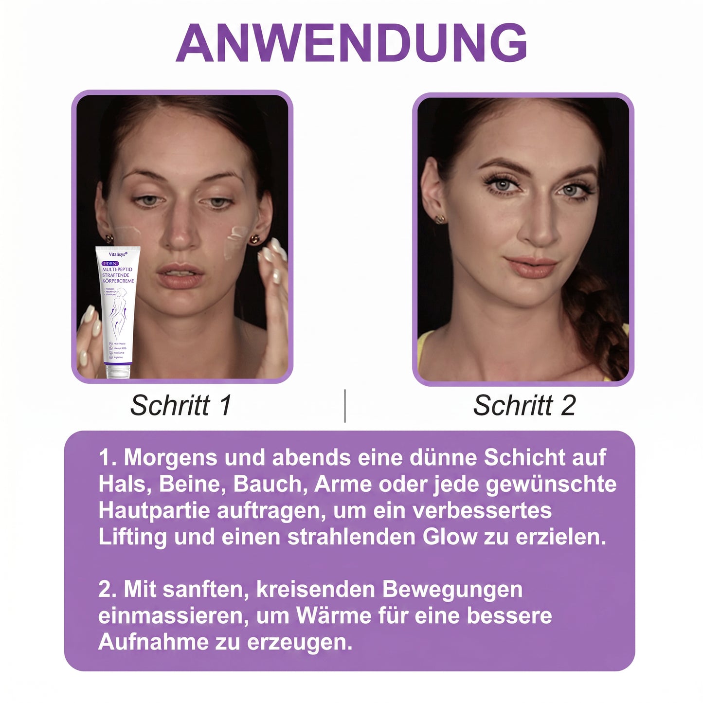 Offizieller Store✅: Vitalisys® PDRN Körpercreme mit Roller ✨ – Anti-Aging, Feuchtigkeitspflege, Hautstraffung, Lifting & Regeneration. Für ebenmäßigen Teint, Behandlung von Akne & Pigmentflecken, Warzen 🥇
