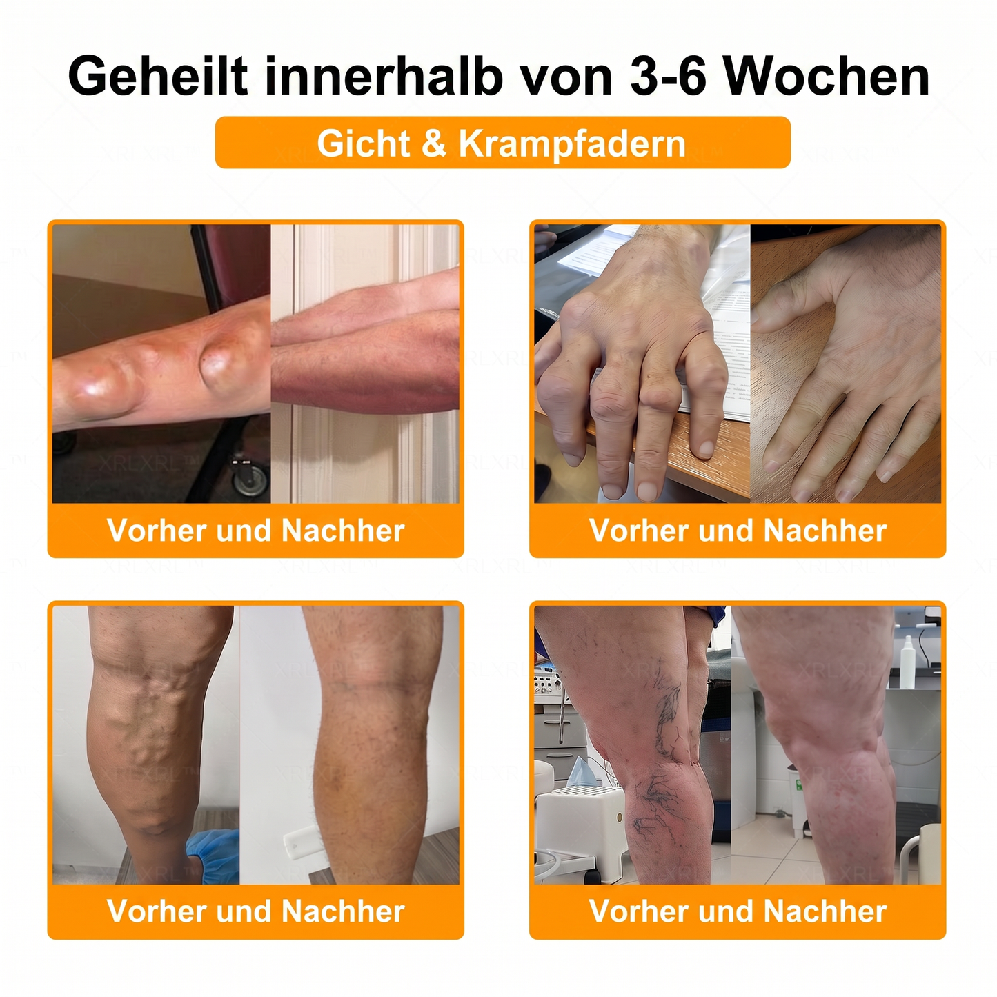 30% Rabatt 🎁🎁 | 𝐌𝐔𝐑𝐖𝐎𝐍® Bienengift-Salbe zur Schmerzlinderung & Knochenheilung ✨