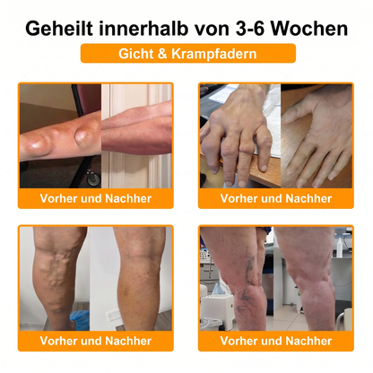 30% Rabatt 🎁🎁 | 𝐌𝐔𝐑𝐖𝐎𝐍® Bienengift-Salbe zur Schmerzlinderung & Knochenheilung ✨