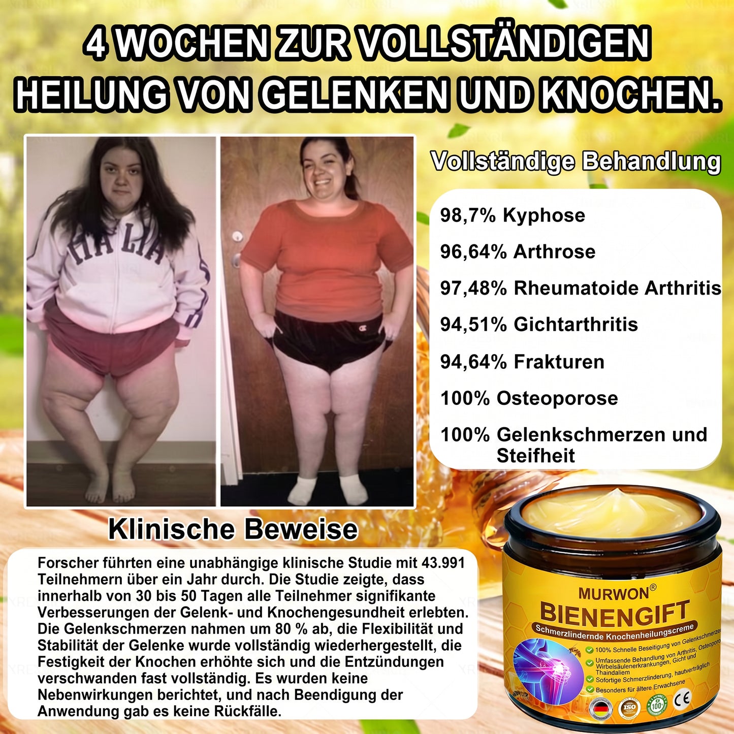 30% Rabatt 🎁🎁 | 𝐌𝐔𝐑𝐖𝐎𝐍® Bienengift-Salbe zur Schmerzlinderung & Knochenheilung ✨