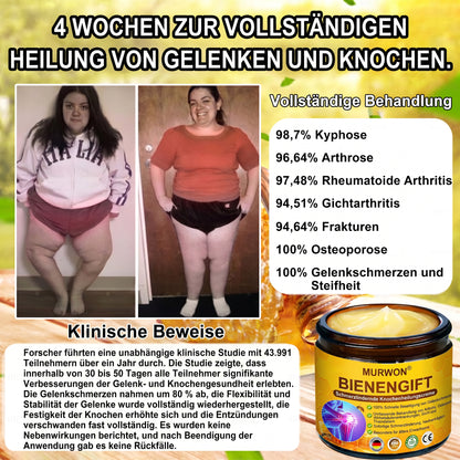 30% Rabatt 🎁🎁 | 𝐌𝐔𝐑𝐖𝐎𝐍® Bienengift-Salbe zur Schmerzlinderung & Knochenheilung ✨