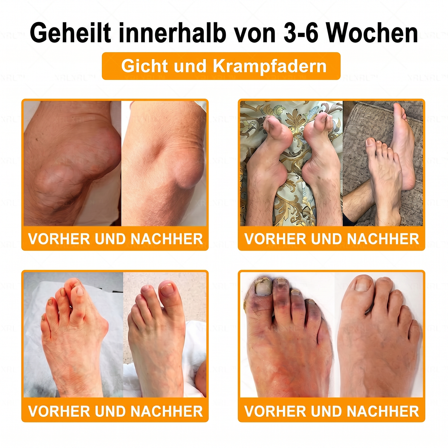 30% Rabatt 🎁🎁 | 𝐌𝐔𝐑𝐖𝐎𝐍® Bienengift-Salbe zur Schmerzlinderung & Knochenheilung ✨