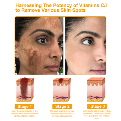 TLOPA®  7-Day Multi-Effect All-in-One Skincare Cream (FDA Approved👨‍⚕️)💖