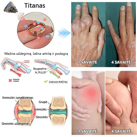 CZTICLE titano plieno magnetinis terapinis žiedas su natūraliu deimantu 🔥 Pirkite daugiau, sutaupykite daugiau 🔥🔥