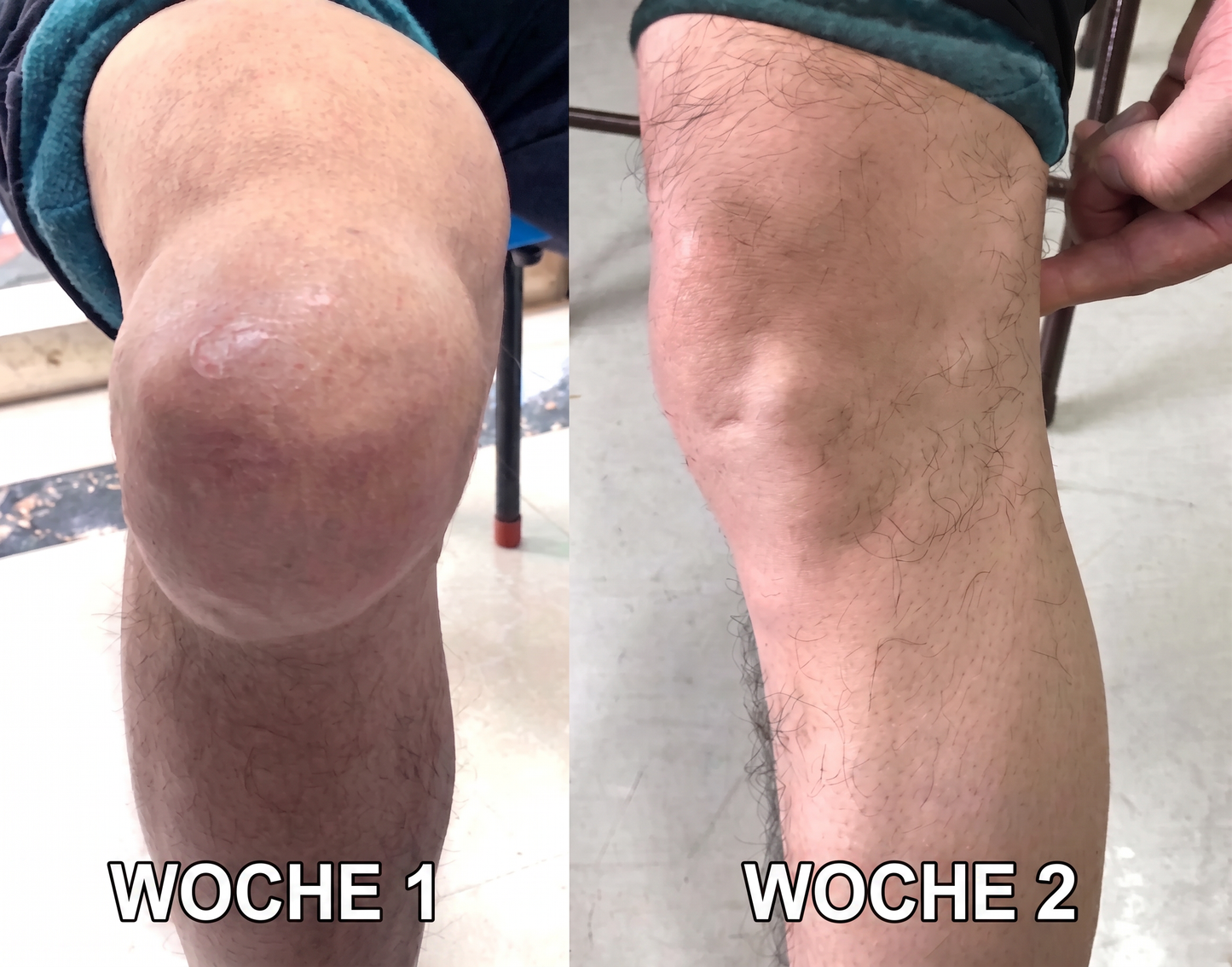 30% Rabatt 🎁🎁 | 𝐌𝐔𝐑𝐖𝐎𝐍® Bienengift-Salbe zur Schmerzlinderung & Knochenheilung ✨