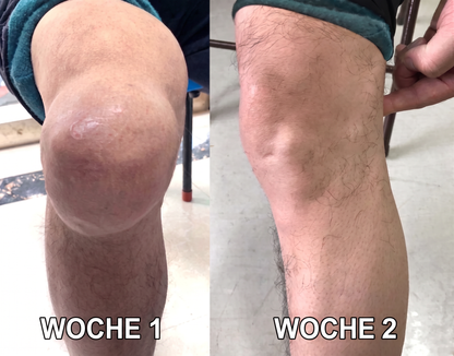 30% Rabatt 🎁🎁 | 𝐌𝐔𝐑𝐖𝐎𝐍® Bienengift-Salbe zur Schmerzlinderung & Knochenheilung ✨