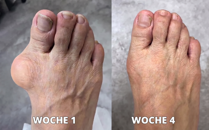 30% Rabatt 🎁🎁 | 𝐌𝐔𝐑𝐖𝐎𝐍® Bienengift-Salbe zur Schmerzlinderung & Knochenheilung ✨