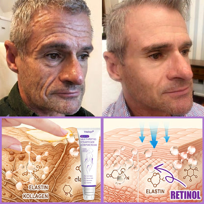 Offizieller Store✅: Vitalisys® PDRN Körpercreme mit Roller ✨ – Anti-Aging, Feuchtigkeitspflege, Hautstraffung, Lifting & Regeneration. Für ebenmäßigen Teint, Behandlung von Akne & Pigmentflecken, Warzen 🥇