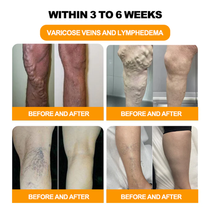 Cvreoz™ 30 žolelių lieknėjimo ir detoksikacijos pėdų vonios karoliukai-🦵👩‍⚕️(LANA sertifikavimas, Amerikos limfologų asociacija)