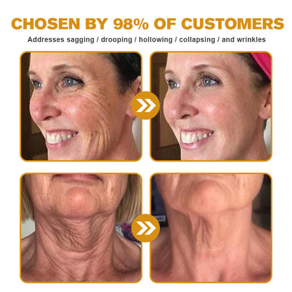 👨‍⚕️ Made and Shipped from USA✅ TLOPA® Botox Bee Venom Wrinkle Removal Cream- LAST DAY 80% OFF